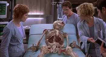 Movie still from “Hollow Man” (2000), directed by Paul Verhoeven – Three people looking at a skeleton in a hospital bed; Medium shot, Over the shoulder angle