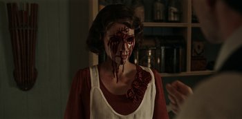 A woman with blood dripping from her face