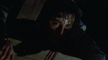 A man with blood dripping down his face