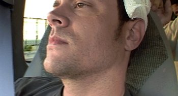 Movie still from “Jackass: The Movie” (2002), directed by Jeff Tremaine – A man's face with a bandage on his head; Close Up shot, High angle