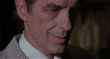 Movie still from “Love Streams” (1984), directed by John Cassavetes – A man's face with blood on it's cheek; Close Up shot, Over the shoulder angle