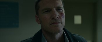 Movie still from “Fractured” (2019), directed by Brad Anderson – A person with a bruise on his face; Close Up shot, Low angle