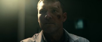 Movie still from “Fractured” (2019), directed by Brad Anderson – A person with a bruise on his face; Close Up shot, Low angle