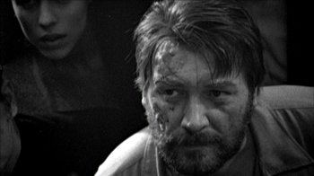 Movie still from “Poison” (1991), directed by Todd Haynes – Black and white photograph of a man's face with bruises; Close Up shot, Over the shoulder angle