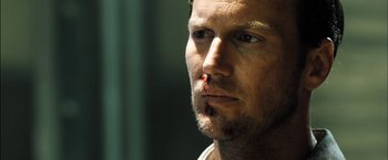 Movie still from “Stretch” (2014), directed by Joe Carnahan – A person with a bruise on his face; Close Up shot, Low angle