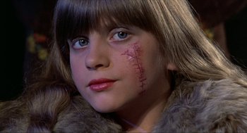 Movie still from “Tommy” (1975), directed by Ken Russell – A young girl with a scar on her face; Close Up shot, High angle