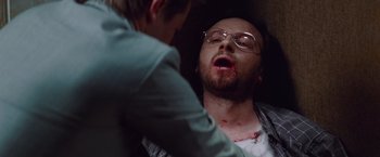 Movie still from “Mission: Impossible - Ghost Protocol” (2011), directed by Brad Bird – A man with a broken nose is being examined by a doctor; Close Up shot, Overhead angle