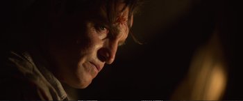 Movie still from “The Glass Castle” (2017), directed by Destin Daniel Cretton – A person's face with a bandage on his head; Close Up shot, Low angle