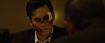 Movie still from “The Raid 2” (2014), directed by Gareth Evans – A man with a bandage on his face and blood on his face; Close Up shot, Over the shoulder angle