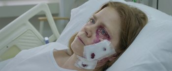Movie still from “The Woman in the Window” (2021), directed by Joe Wright – A woman in a hospital bed with bandages on her face; Close Up shot, High angle