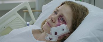 Movie still from “The Woman in the Window” (2021), directed by Joe Wright – A woman in a hospital bed with a bandage on her face; Close Up shot, High angle