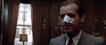 Movie still from “Chinatown” (1974), directed by Roman Polanski – A man with a bandage on his nose; Close Up shot, Low angle