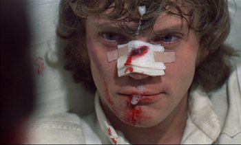 Movie still from “A Clockwork Orange” (1971), directed by Stanley Kubrick – A young man with bandages on his face; Close Up shot, High angle