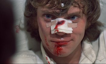 Movie still from “A Clockwork Orange” (1971), directed by Stanley Kubrick – A man with bandages on his head and face; Close Up shot, High angle