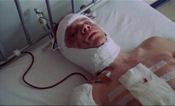Movie still from “A Clockwork Orange” (1971), directed by Stanley Kubrick – A man with bandages on his head laying in a hospital bed; Close Up shot, Overhead angle