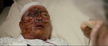 Movie still from “Crash” (2004), directed by Paul Haggis – An old man in a hospital bed with a bandage on his head; Close Up shot, Overhead angle