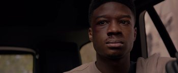 Movie still from “The Hate U Give” (2018), directed by George Tillman Jr. – A person with a bruise on his face; Close Up shot, Low angle