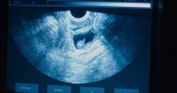 Movie still from “Cow” (2021), directed by Andrea Arnold – View of a computed tomography image; Extreme Close Up shot, Overhead angle