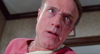 Movie still from “Misery” (1990), directed by Rob Reiner – A person with a bruise on his face; Close Up shot, Low angle