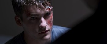 Movie still from “Notorious Nick” (2021), directed by Aaron Leong – A young man with a bandage on his face; Close Up shot, Over the shoulder angle