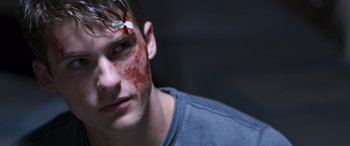 Movie still from “Notorious Nick” (2021), directed by Aaron Leong – A young man with a bandage on his face; Close Up shot, Over the shoulder angle