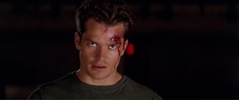 Movie still from “Scream 2” (1997), directed by Wes Craven – A person with a face injury; Close Up shot, Over the shoulder angle