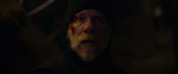 Movie still from “Sick” (2022), directed by John Hyams – A man with a beard and a hat with a bruise on his face; Close Up shot, Low angle