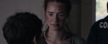 A young woman with a bruised face looking at the camera