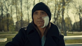 Movie still from “Fargo” (2014), created by Noah Hawley – A man with a bandage on his face; Close Up shot, Over the shoulder angle
