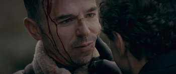 Movie still from “Wild Bill” (2011), directed by Dexter Fletcher – A person with a bandage on his face; Close Up shot, Over the shoulder angle