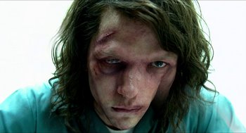 Movie still from “American Ultra” (2015), directed by Nima Nourizadeh – A person with a bruised face; Close Up shot, Low angle
