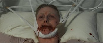 Movie still from “Goodnight Mommy” (2014), directed by Severin Fiala – A woman with a bandaged head and mouth covered in blood; Close Up shot, High angle