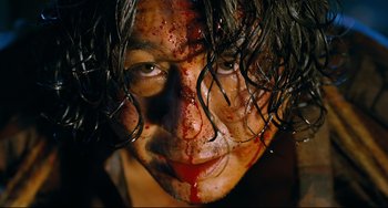 A person with blood on their face