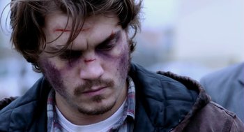 Movie still from “Killer Joe” (2011), directed by William Friedkin – A person with bruises on his face; Close Up shot, Over the shoulder angle