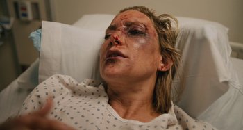 Movie still from “Mona Lisa and the Blood Moon” (2021), directed by Ana Lily Amirpour – A woman in a hospital bed with bruises on her face; Close Up shot, Over the shoulder angle