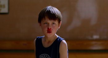 Movie still from “St. Vincent” (2014), directed by Theodore Melfi – A young boy with a red injury on his face; Close Up shot, Low angle