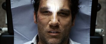 Movie still from “The International” (2009), directed by Tom Tykwer – A man's face with a bruise on his face; Close Up shot, Low angle