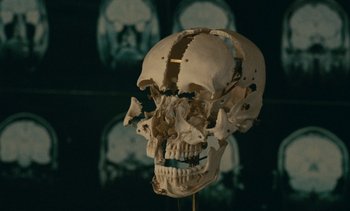 Movie still from “7 Rm., kit., ba...” (1984), directed by Agnès Varda – A human skull is shown in front of a wall of x - rays; Extreme Close Up shot, Overhead angle
