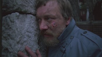 A man with a beard and a patch on his face