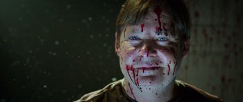 A man with blood all over his face